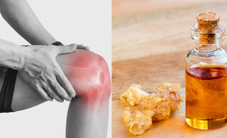 What Does Boswellia Do for Your Joints?