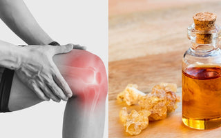 What Does Boswellia Do for Your Joints?